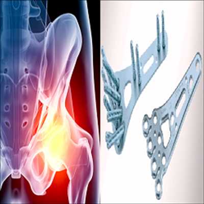 Appareils orthopédiques de traumatologie Market